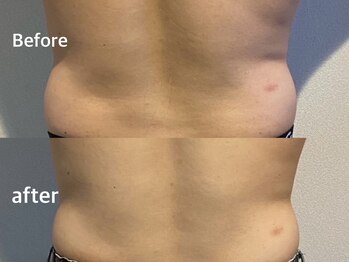 ボヌールデソワ(Bonheur de Soi)/痩身エステ