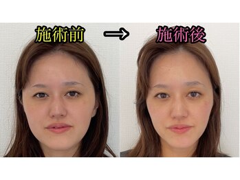 シャルム(Charme)