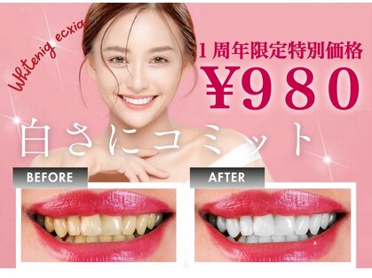 エクシアホワイトニング 盛岡中央通店の写真