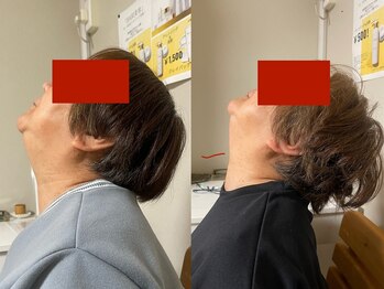 スーピー(SuuuPeee)/【ビフォーアフター】