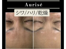 オーリス(Aurise)/