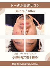 シャルール プラス(Chaleur+)/