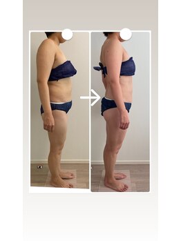 ビンナ 五反田店(Binna)/ノンF筋膜リリース