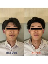 ククナ 桜木町駅前/小顔矯正ビフォーアフター