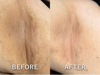 ドアディ(Doordie)/ローマピンク