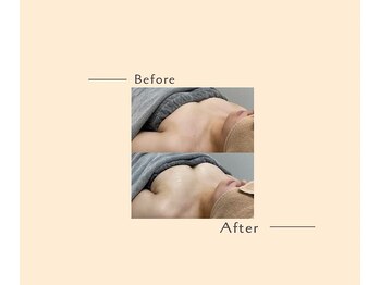 オベリオ(OBERIO)/