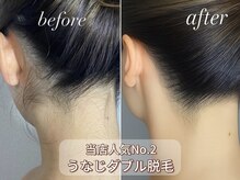 エピナス 町田店(epinus)の雰囲気(ワックス脱毛でさわり心地の良いすべすべ肌を手に入れて★)