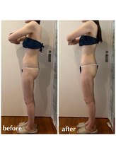 リモアボーテ(RIMOA beaute)/【セルゼロ】before→after