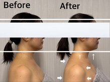 ベール(BEHL)/コルギBeforeAfter