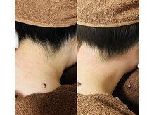 ラマジ(Lamazi)/うなじワックス脱毛