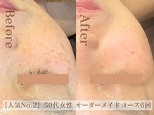 ディレイア ザ コスメ 有楽町マルイ店(direia the cosme)