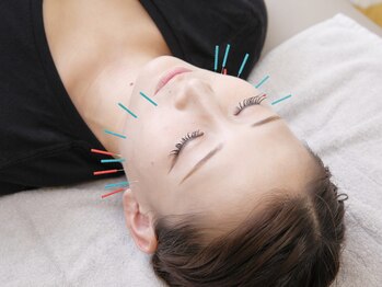 ネイビー鍼灸指圧治療院(NAVY鍼灸指圧治療院)/美容鍼