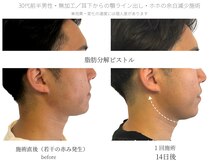 サボラミ(sabor A Mi)/男性も小顔化で印象UP☆