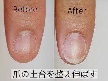ネイルエニー(Nail Any)の写真/3か月で変化を実感◎ネイルプランナーによる深爪・自爪育成メニュー