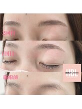 クリオ(CLIO)/ハリウッドブロウリフト経過