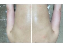 ハートランド(HEARTLAND)/クレオパトラコース　1回の施術