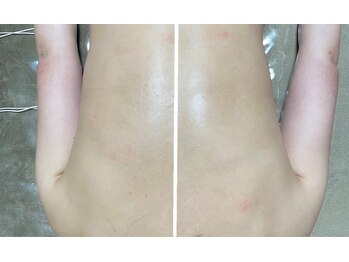 ハートランド(HEARTLAND)/クレオパトラコース 1回の施術