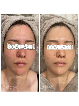 コアラッシュ 福井フェニックス通り店(COA LASH)/紫外線ダメージは肌の休憩を♪