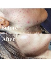 エステティックス ナインワンワン 横浜(Esthetics911) /フェイシャル1回施術で効果◎