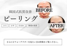 カナロア 宇都宮店(Kanaloa)