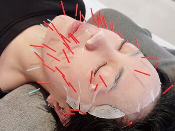 リカバリー (Recovery)