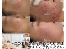 ユーエステティック(U AESTHETIC)