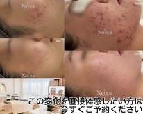 ユーエステティック(U AESTHETIC)