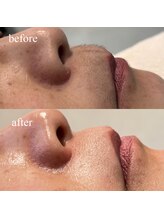 ラ ソレイユ(Le Soleil)/フェイシャルワックス