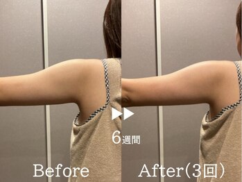 ルナステラ 七尾店/サーモシェイプDEEP