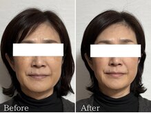 リタ(Rita.)の雰囲気（浮腫み、たるみ、歪み、広がりもおまかせ）