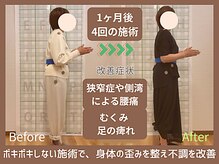 ほねつぎ極癒の雰囲気（お身体に負担をかけずに、正しい姿勢に整えていきます。）