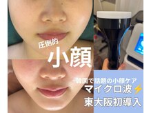 サロン エム(Salon M)の雰囲気(1度で実感、回数重ねるごとに小顔が加速!肌別美容液で美肌にも!)
