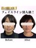 【人気No.1】鏡を見るたび気になるたるみに!頭から整える若見え小顔8,800円