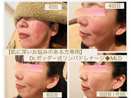ホイ(Hui)の写真
