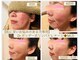 ホイ(Hui)の写真