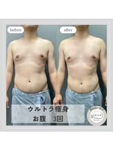 カラー(CALLA)/メンズにも大人気☆ウルトラ痩身