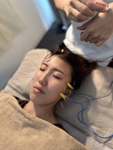 ハリサロンドオフ 南森町店(hari salon de off)/お顔の鍼の最中はウトウト