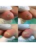副爪2ヵ所（小指の爪横にある爪ではないもの）＋爪切りセット ¥6600