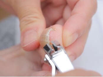 レリーズ ネイル(Lelys nail)の写真/巻き爪/自爪にお悩みの方必見★巻き爪ケアを専門知識を持ち合わせたネイリストが丁寧にカウンセリング♪