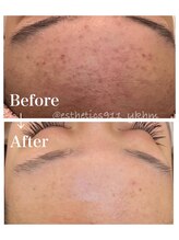 エステティックス ナインワンワン 横浜(Esthetics911) /フェイシャル1回施術で効果◎