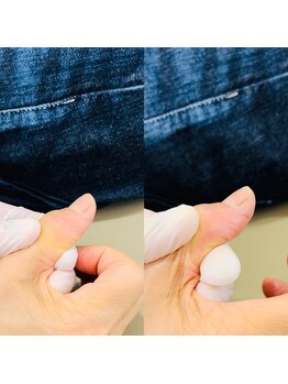 ランドル(rendre)/親指が曲がらない