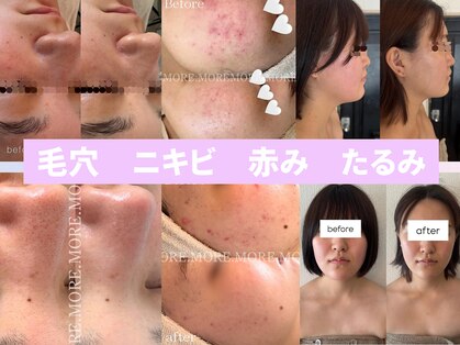 モア 吉祥寺(MORE.)の写真