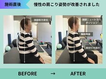 トミーリハ整体院(TOMMY REHA整体院)/猫背/巻き肩/姿勢改善もお任せ！
