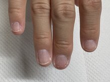 ブルームーンネイルズ(BLOOMOON.nails)の雰囲気（【深爪/噛み爪/むしり爪】気になるお爪の悩みご相談ください）