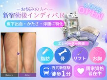 術後インディバ アール 新宿(R)