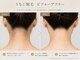 フランク(Frank)の写真/面倒な自己処理から卒業！お肌の負担を最小限に抑えた脱毛で、つるすべ肌に♪脱毛デビューの方にも◎