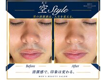空スタイル(空STYLE)の雰囲気（メンズ脱毛/vio/全身/光フェイシャル/ハーブピーリング/毛穴洗浄）