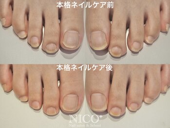 ニコプラス(NICO+)/爪育ネイルケア