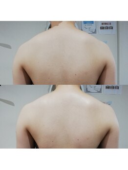 RiとBiのたまご/(ブライダル)引き締め