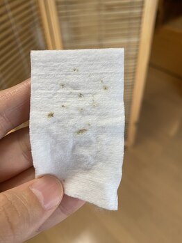 ラーナ(Lana)/毛穴洗浄